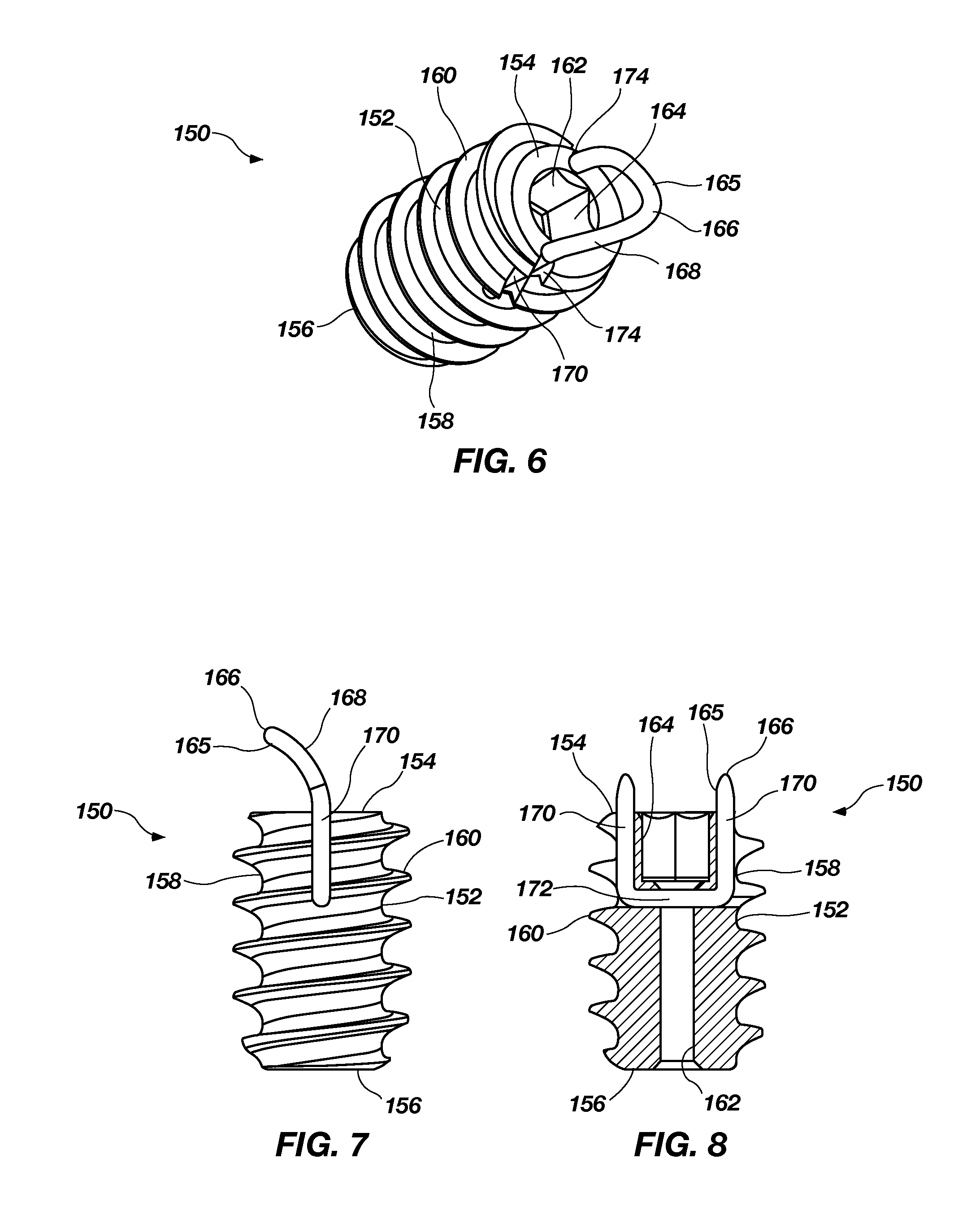 Tenodesis system