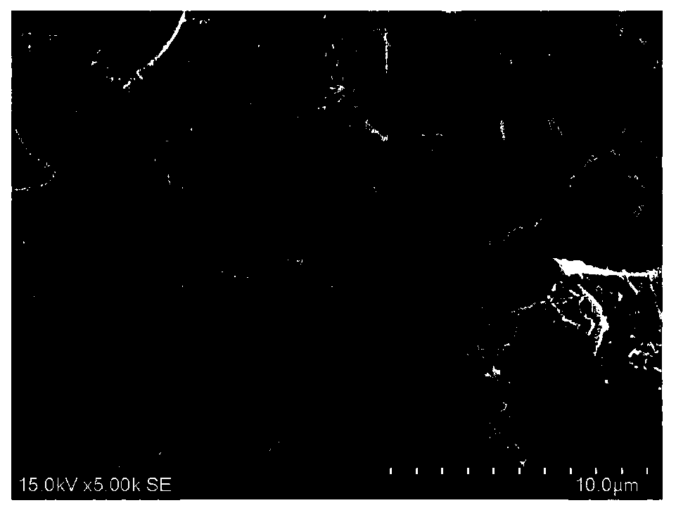 Freeze-drying technology of bortezomib for injection