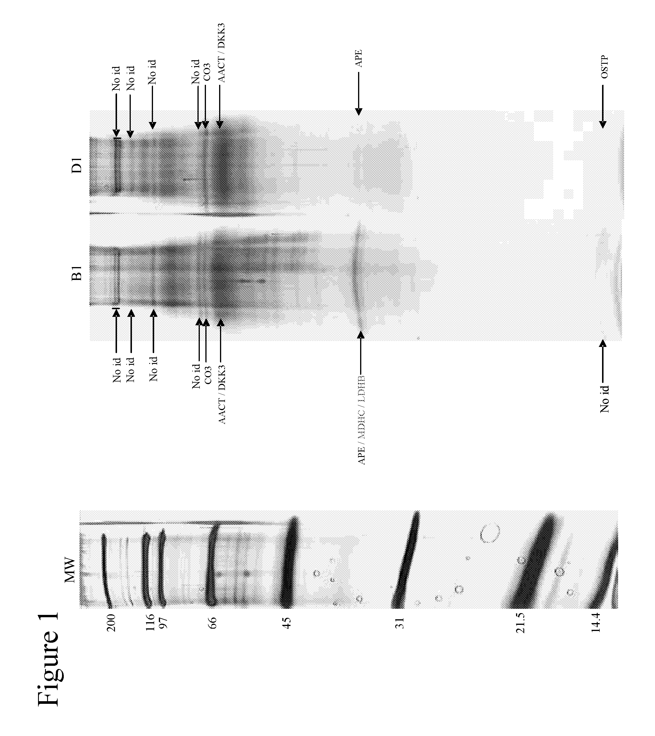 Diagnostic Method for Brain Damage-Related Disorders