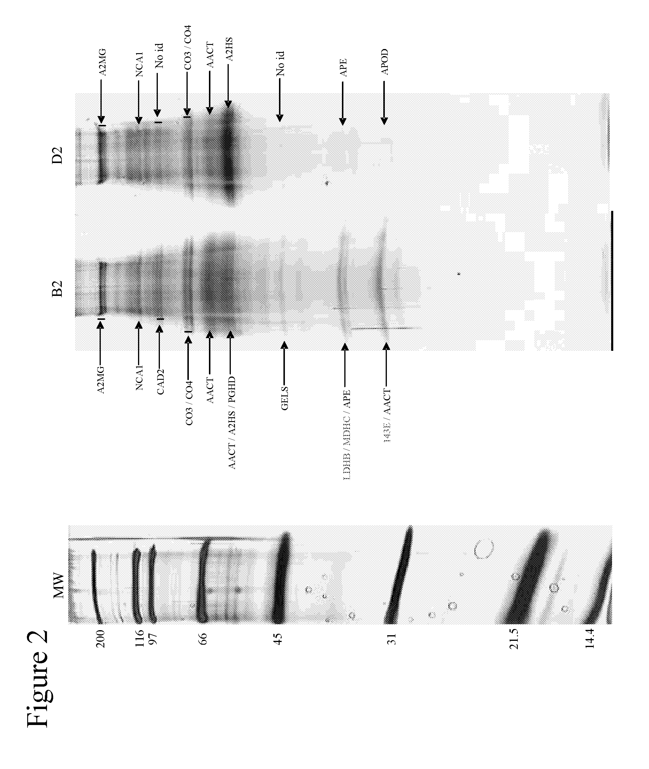 Diagnostic Method for Brain Damage-Related Disorders