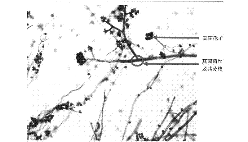 Improved periodic acid Schiff reaction rapid staining kit