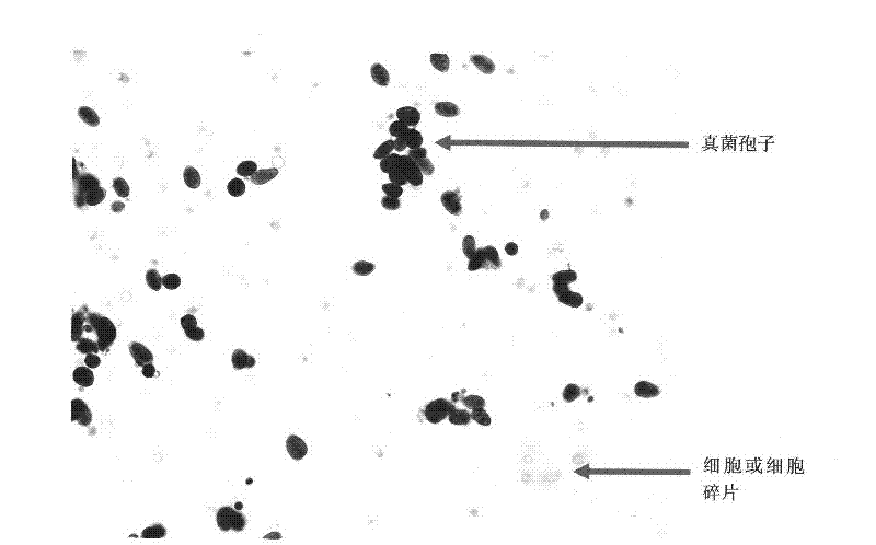 Improved periodic acid Schiff reaction rapid staining kit