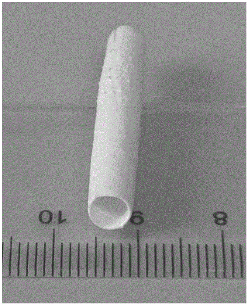 Natural-blood-vessel-simulating three-layer artificial blood vessel stent and preparation method thereof