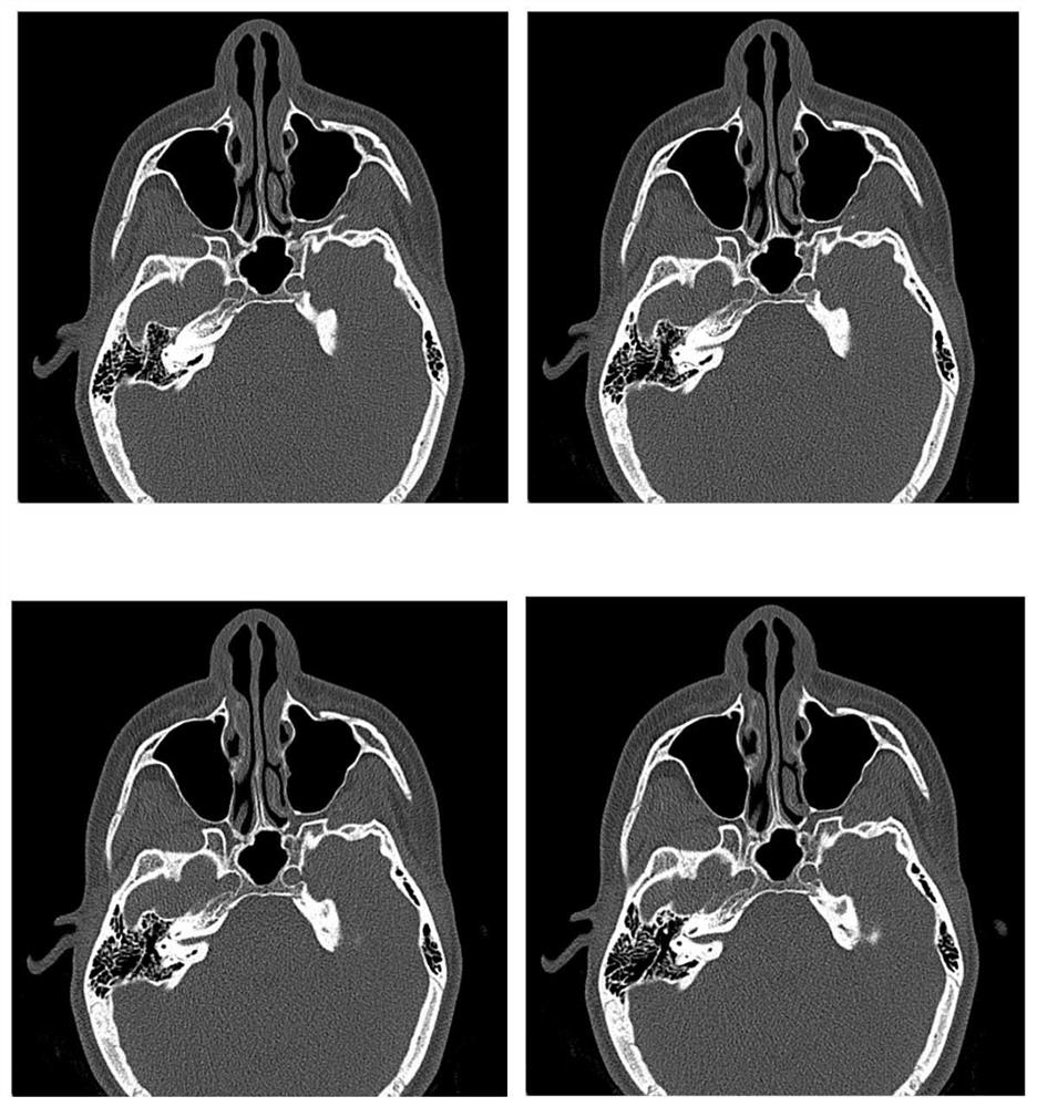 Multi-section medical image compression method based on three-dimensional discrete wavelet transform