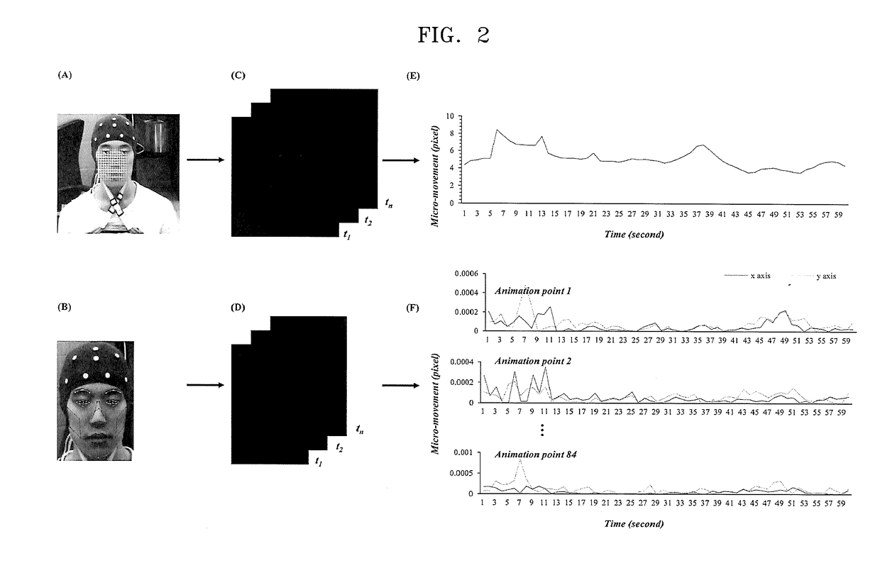 Method and system for detecting information of brain-heart connectivity by using pupillary variation