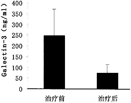 Preparation method of kit for early-to-mid rapid diagnosis of ovarian cancer