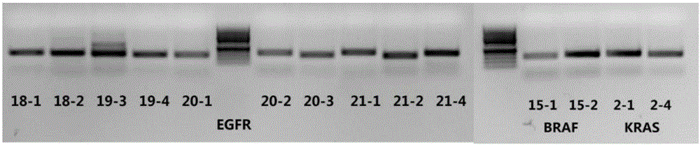 Multi-PCR primer for detecting EGFR/KRAS/BRAF genetic mutation locus based on next-generation sequencing technology and method and application