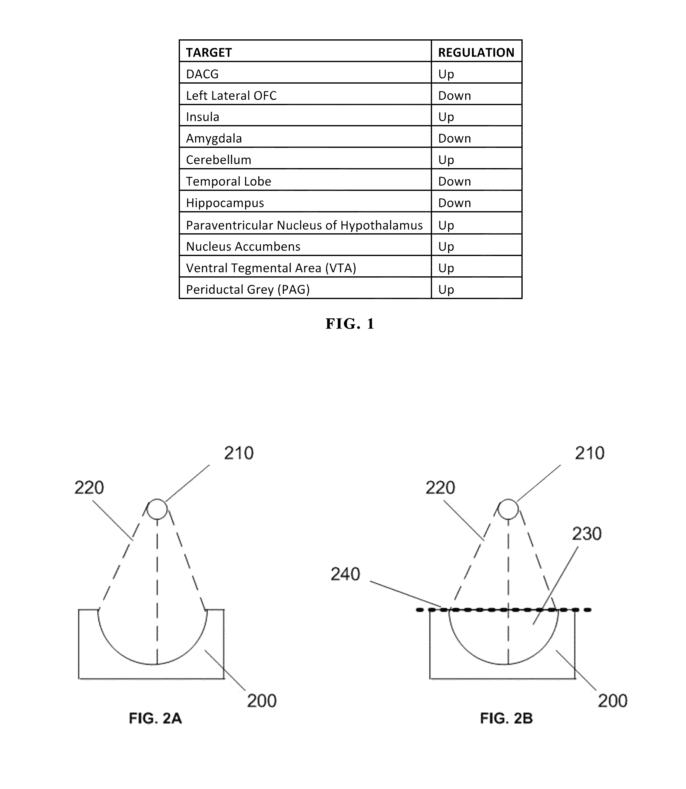 Stimulation method via deep brain stimulation