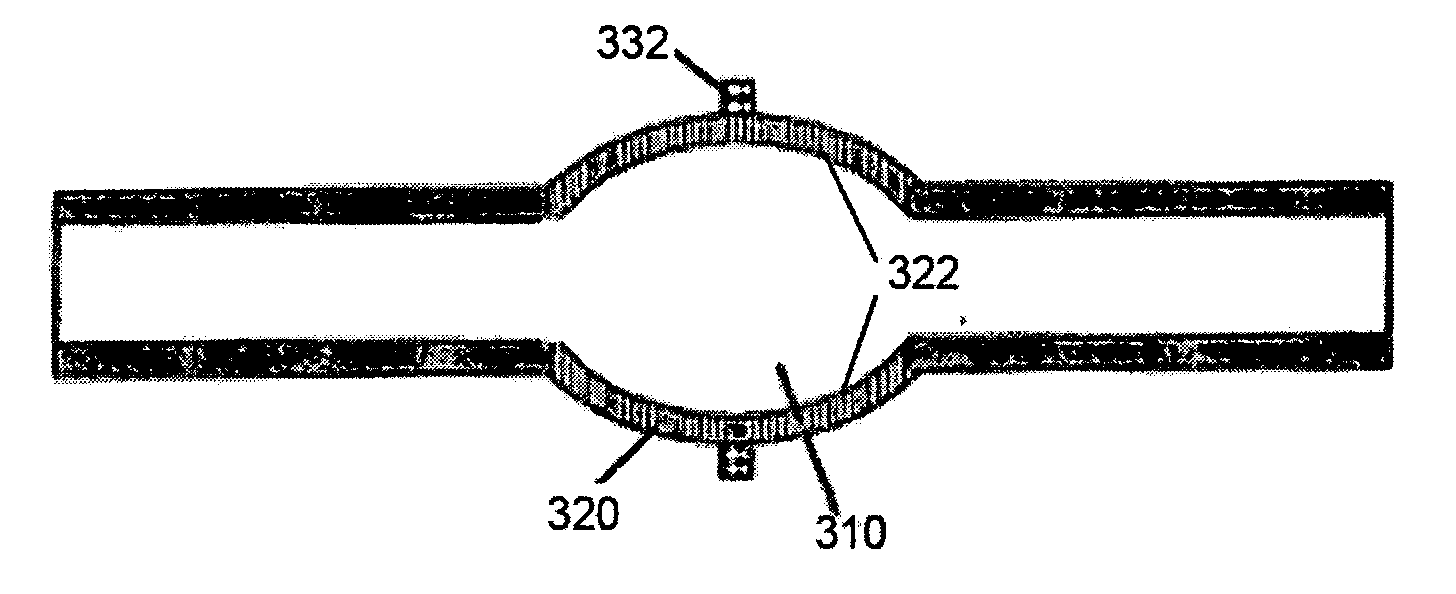 Method and system for detecting an occlusion in a tube