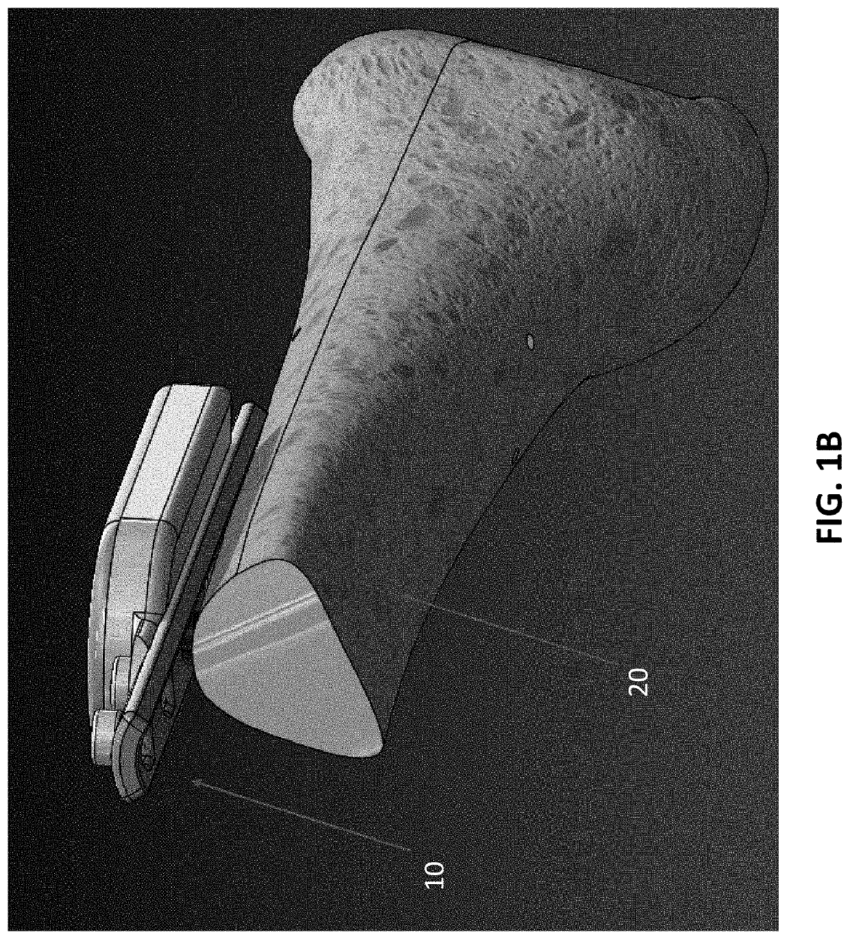 Orthopedic treatment device with electromagnetic field generator