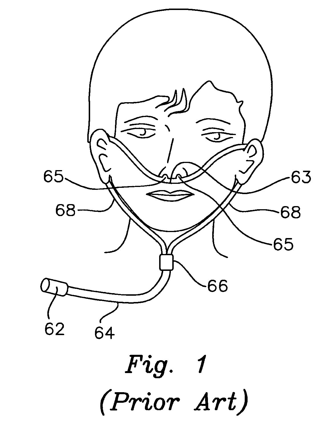 Nasal cannula