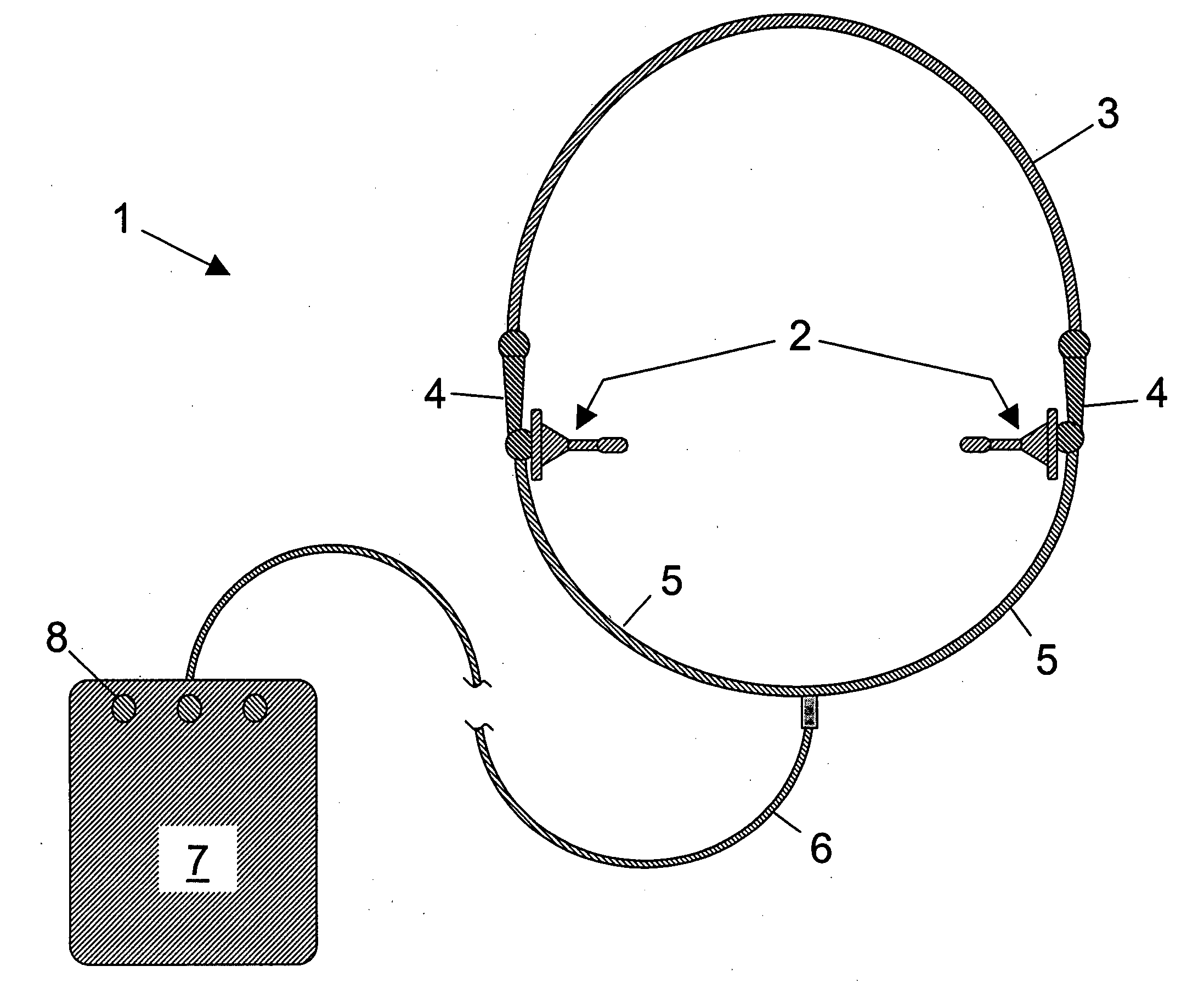 Apparatus, system and method for detecting and treating airway obstructive conditions during sleep