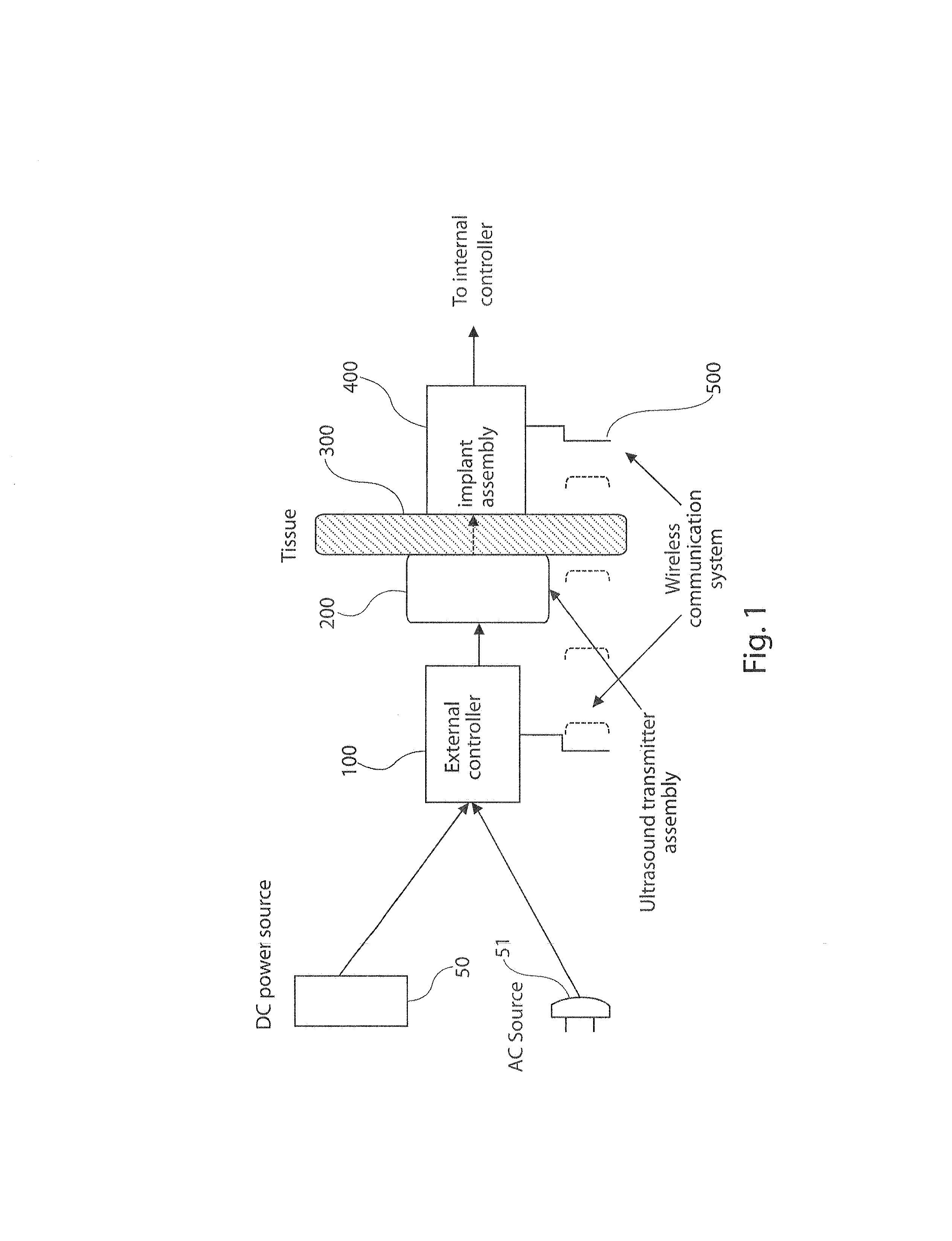 High power ultrasound wireless transcutaneous energy transfer (us-tet) source