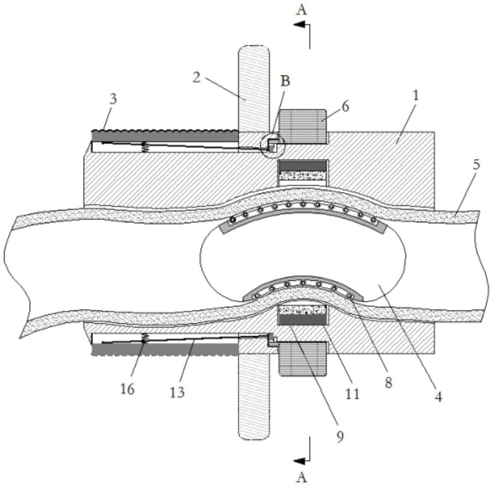 Anti-bite ventilation catheter for nursing in cardiovascular medicine