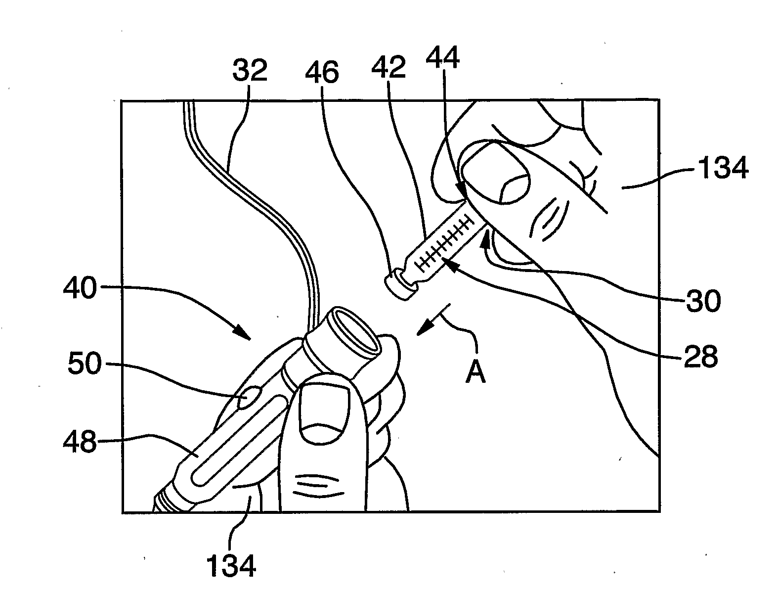 Method of Delivery of Therapeutic Metal Ions, Alloys and Salts