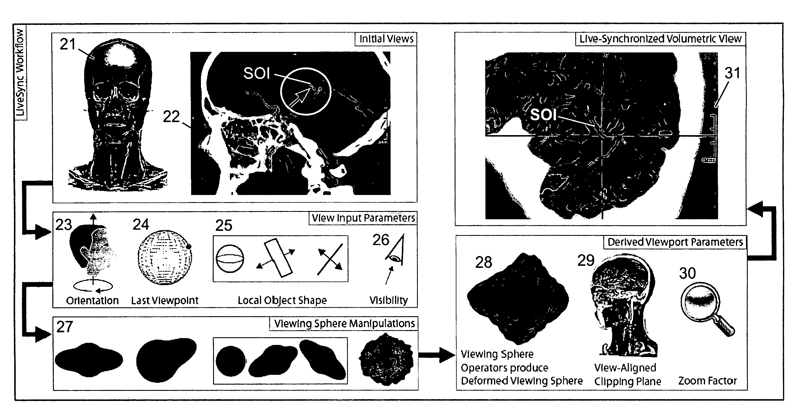 Method and Apparatus for Volume Rendering of Medical Data Sets