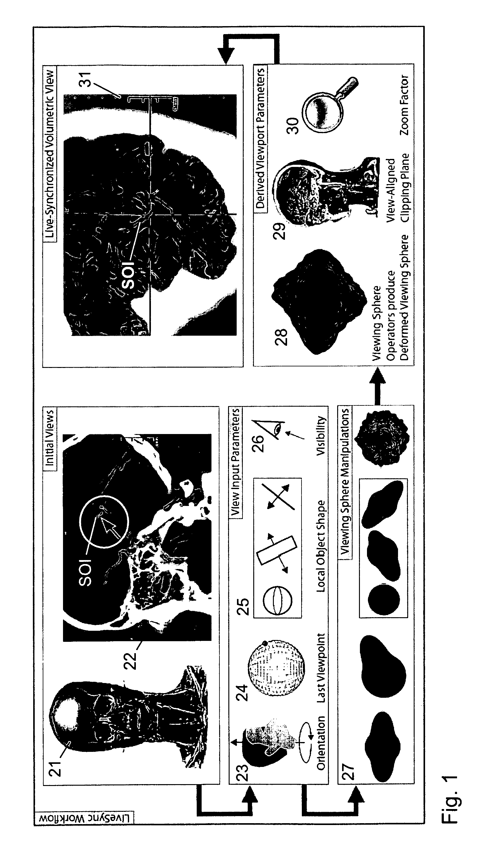 Method and Apparatus for Volume Rendering of Medical Data Sets