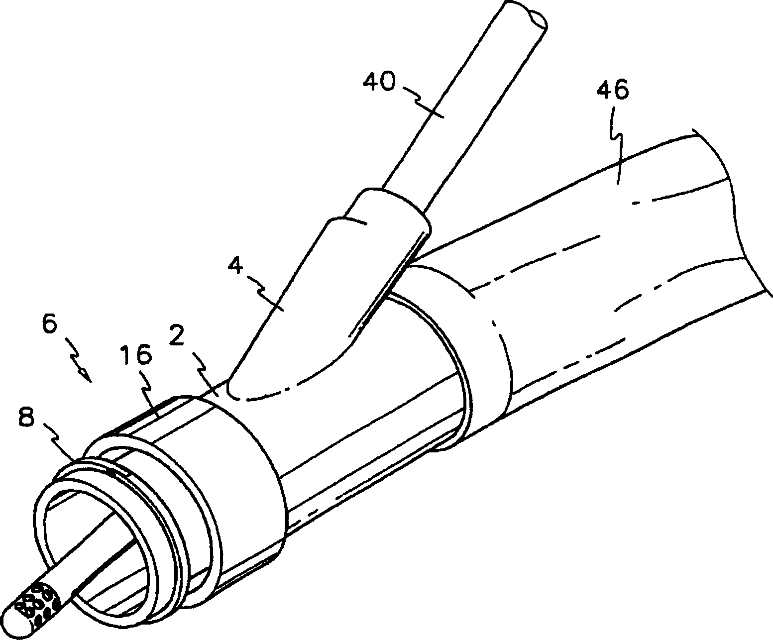 Colonic irrigator