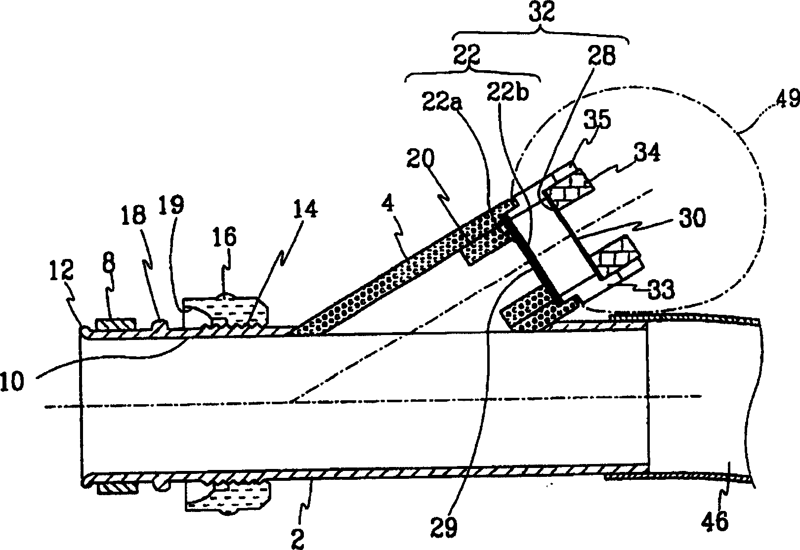 Colonic irrigator