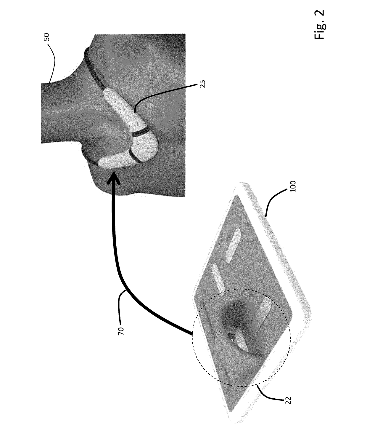 Combined floormat and body-worn physiological sensors