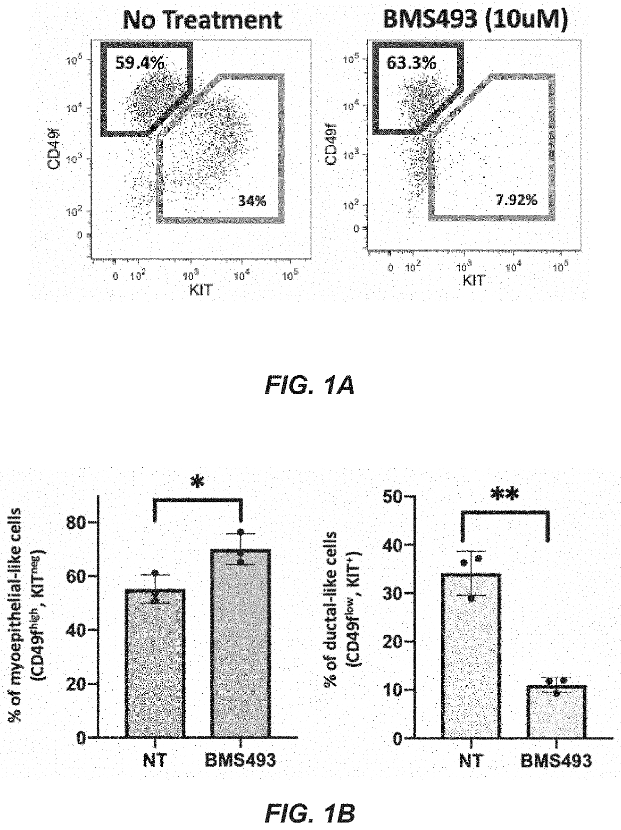 Method of treating adenoid cystic carcinoma