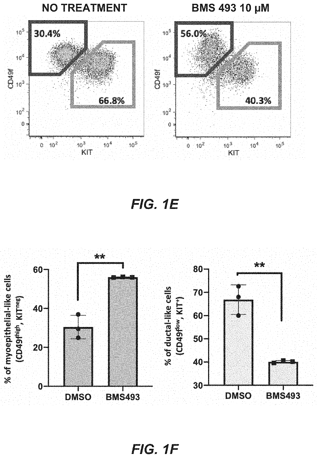 Method of treating adenoid cystic carcinoma