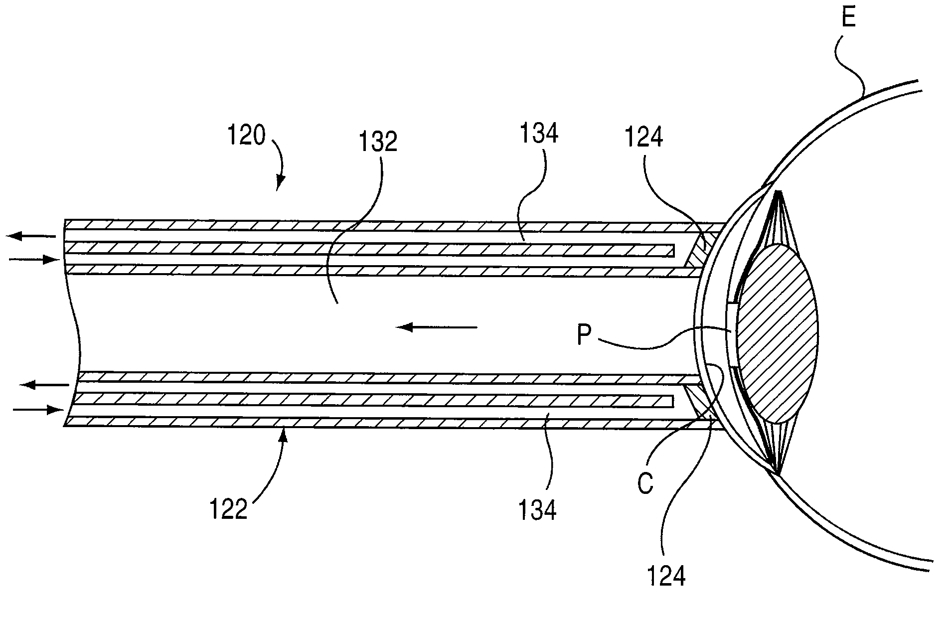 Apparatus and method for treating visual disorders