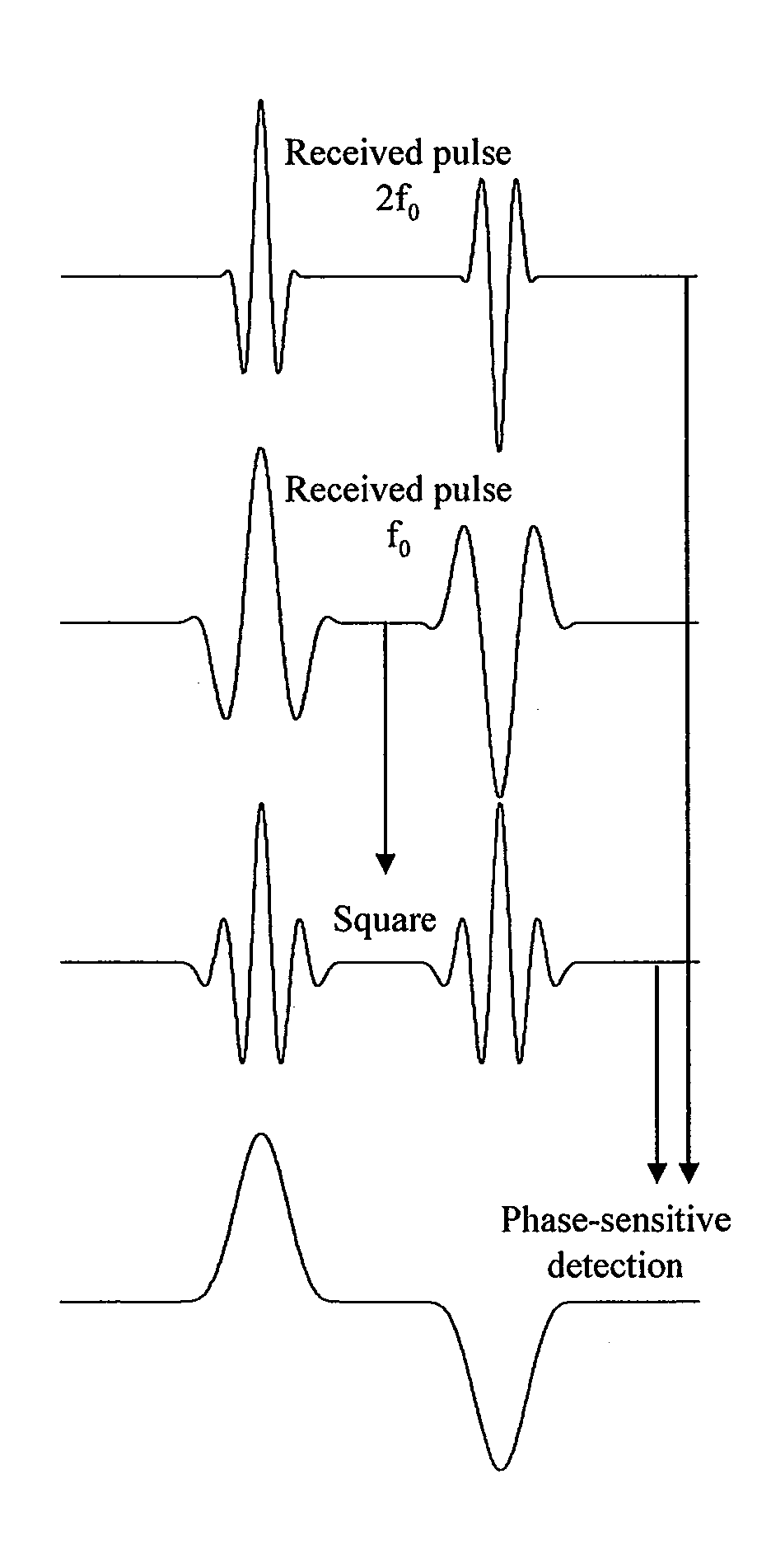 Ultrasound imaging apparatus