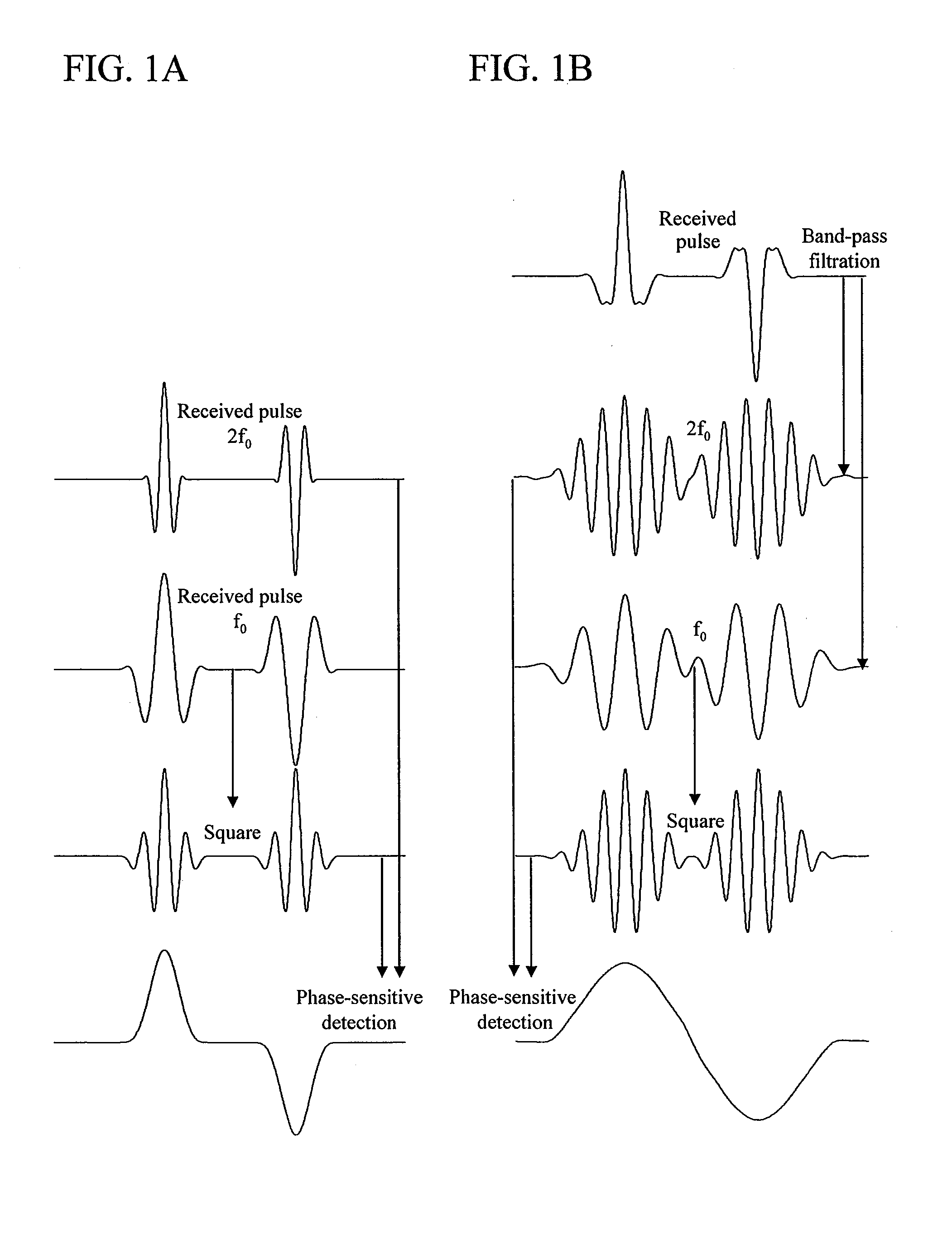 Ultrasound imaging apparatus