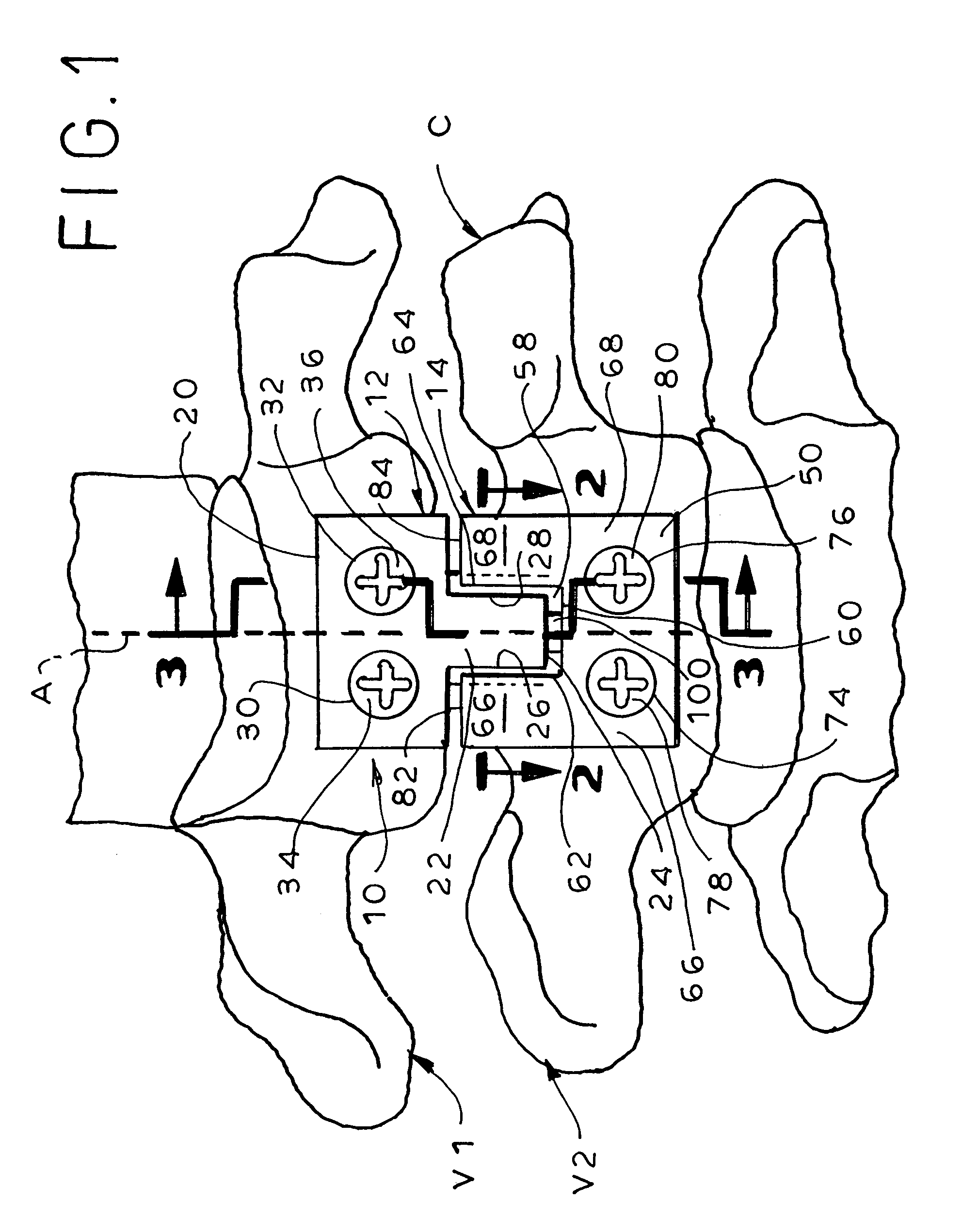 Methods and apparatus for promoting fusion of vertebrae