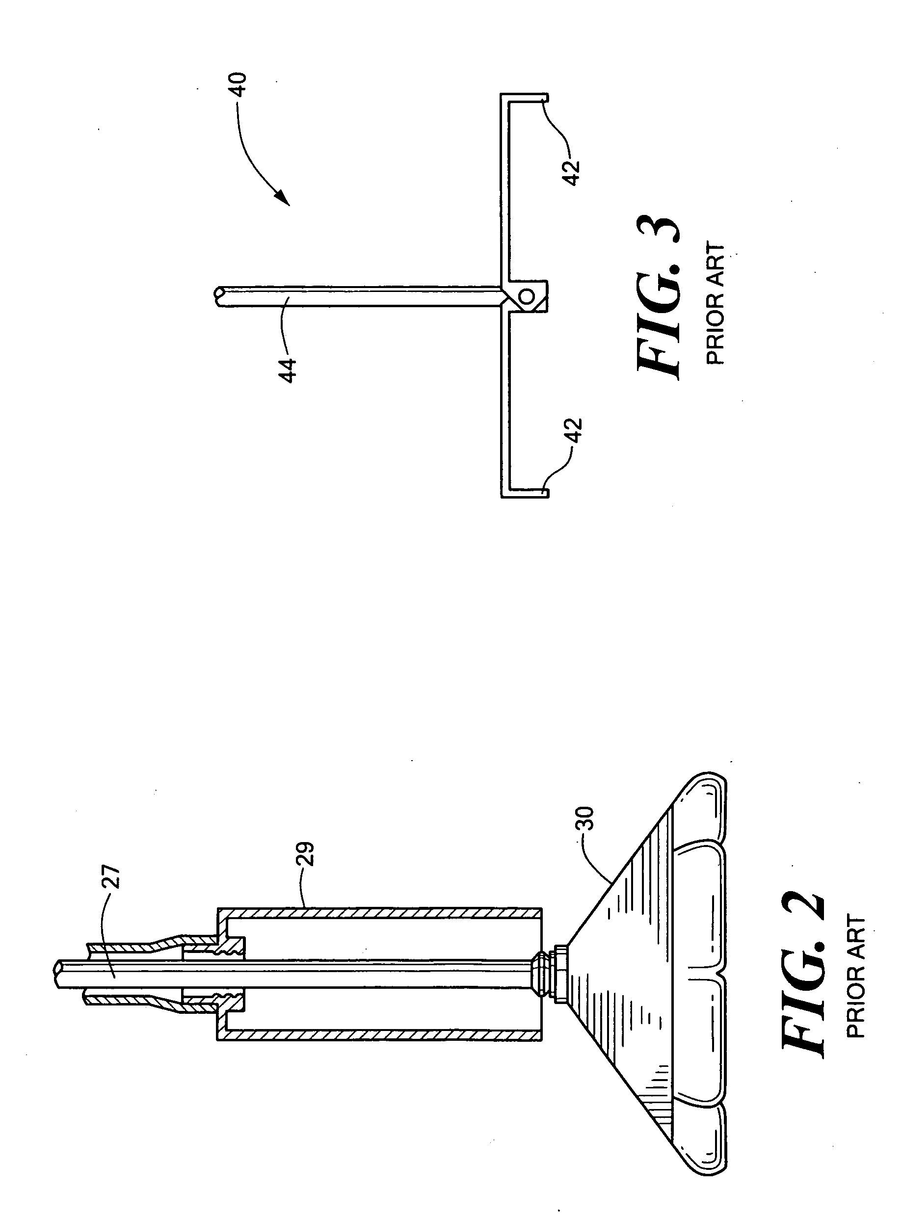 Endovascular tissue removal device