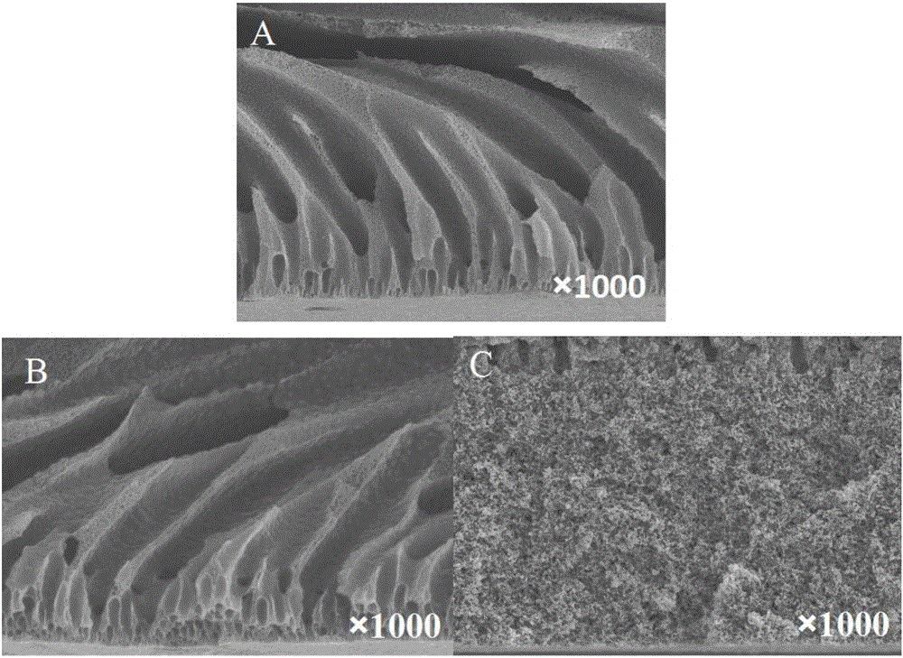 Preparation method for hydrophilic polyvinylidene fluoride (PVDF) antibacterial ultrafiltration membrane