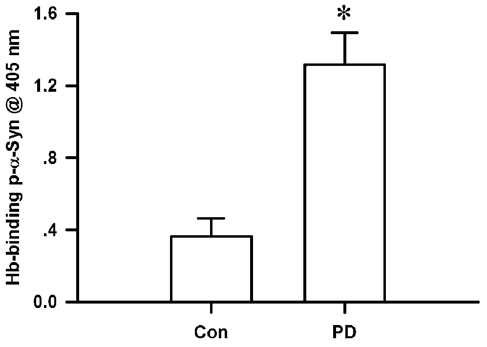 Method for detecting hemoglobin-combined phosphorylated alpha-synuclein