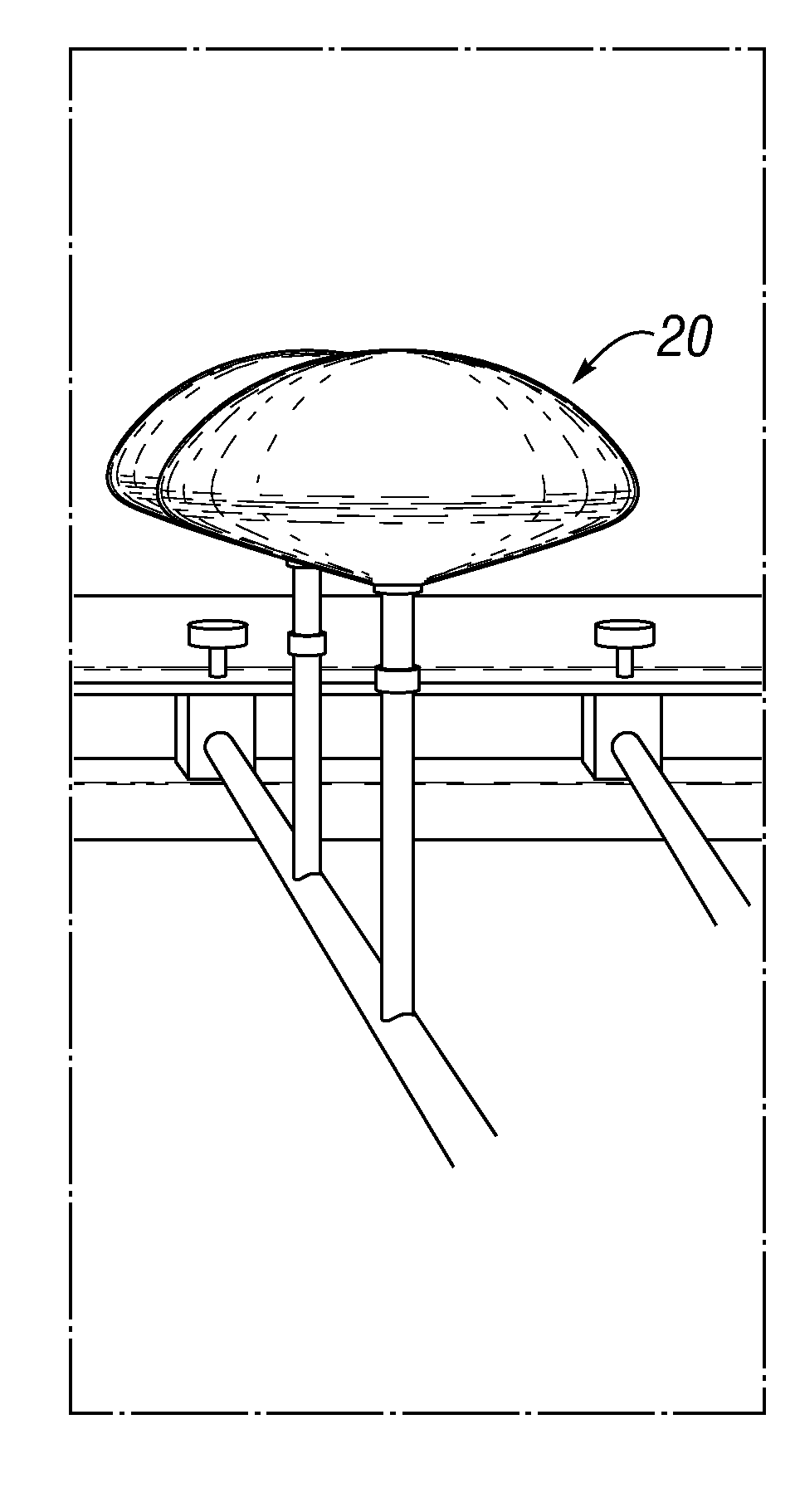 All-barrier elastomeric gel-filled breast prosthesis