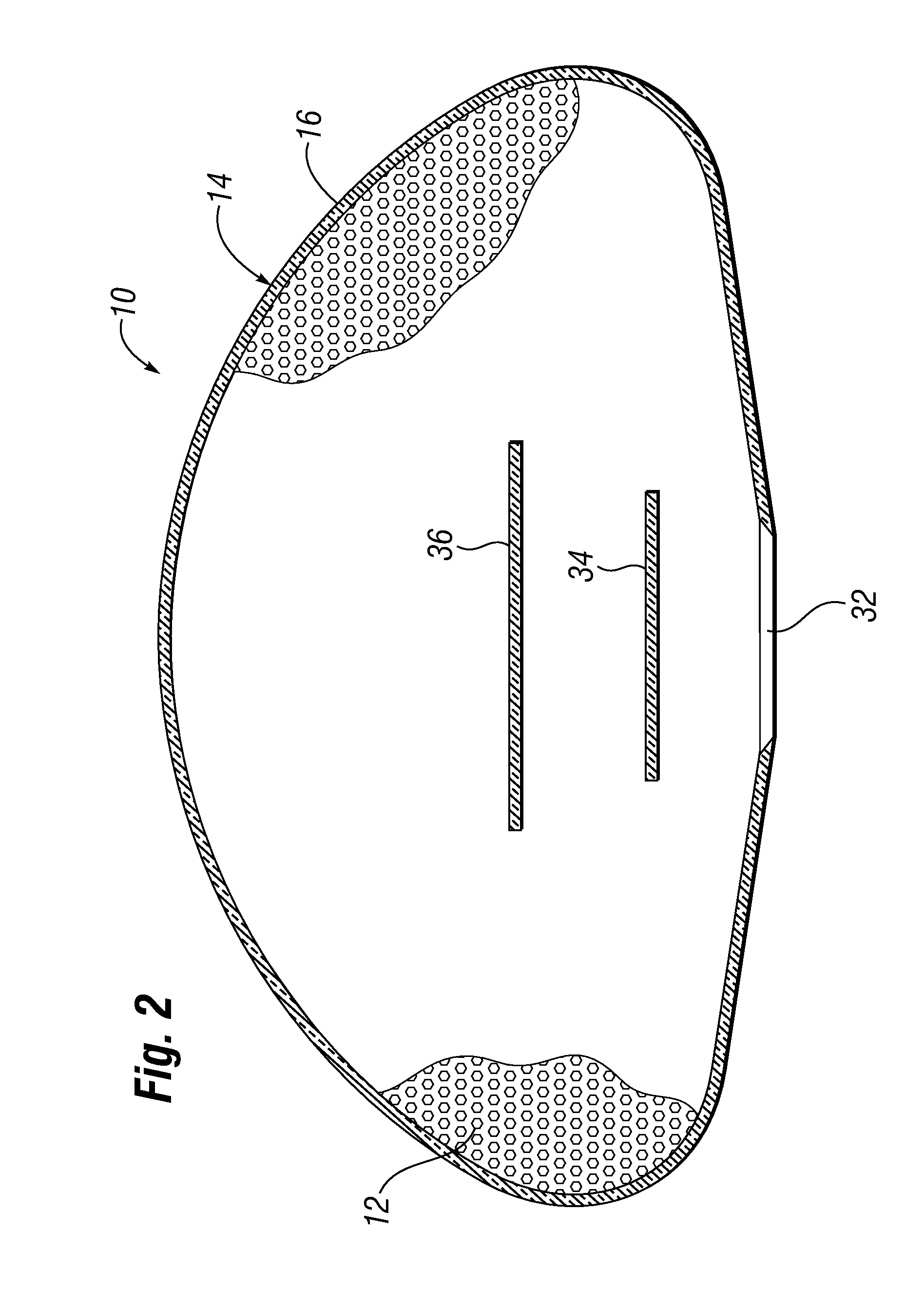 All-barrier elastomeric gel-filled breast prosthesis