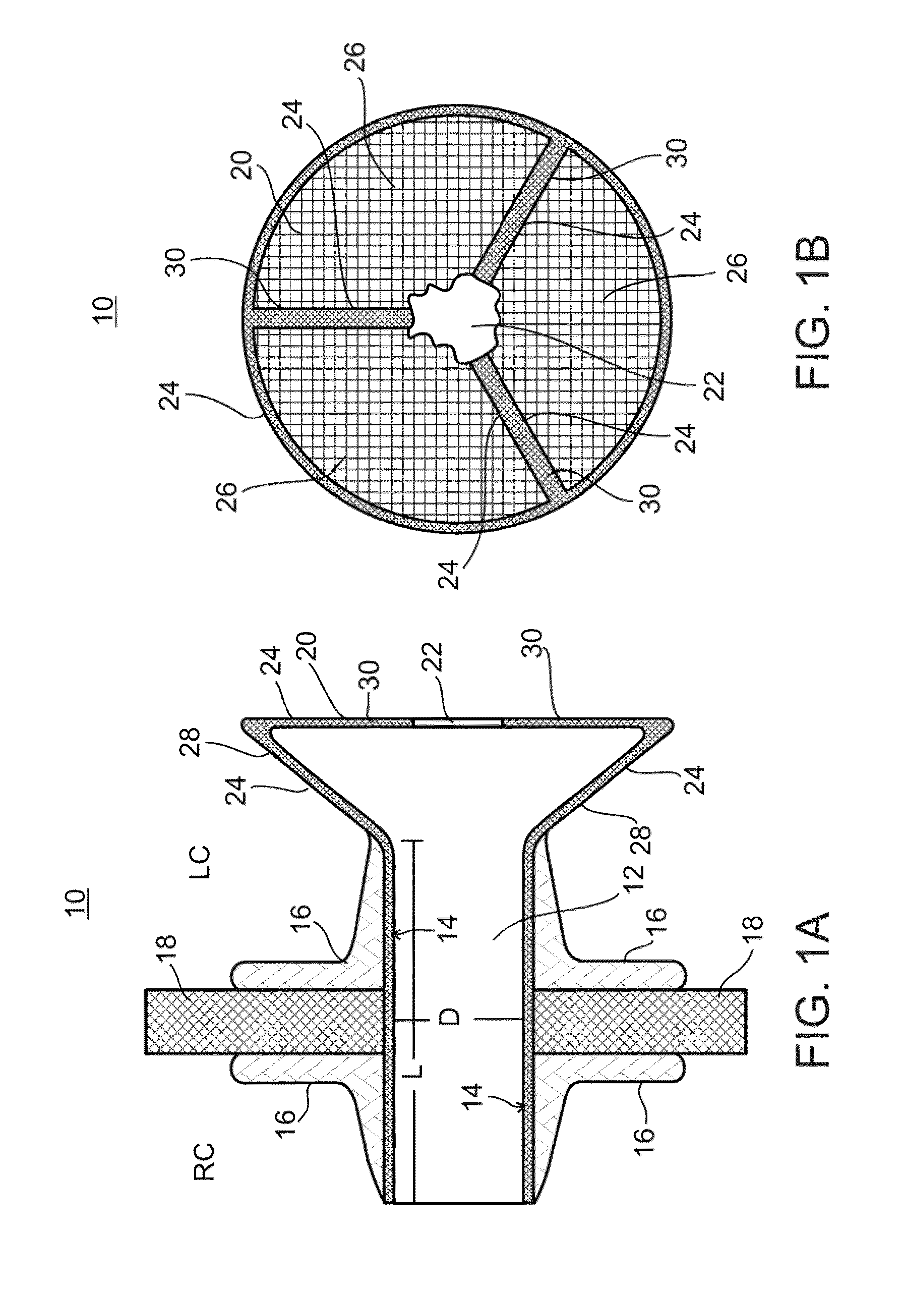 Device and method for regulating pressure in a heart chamber