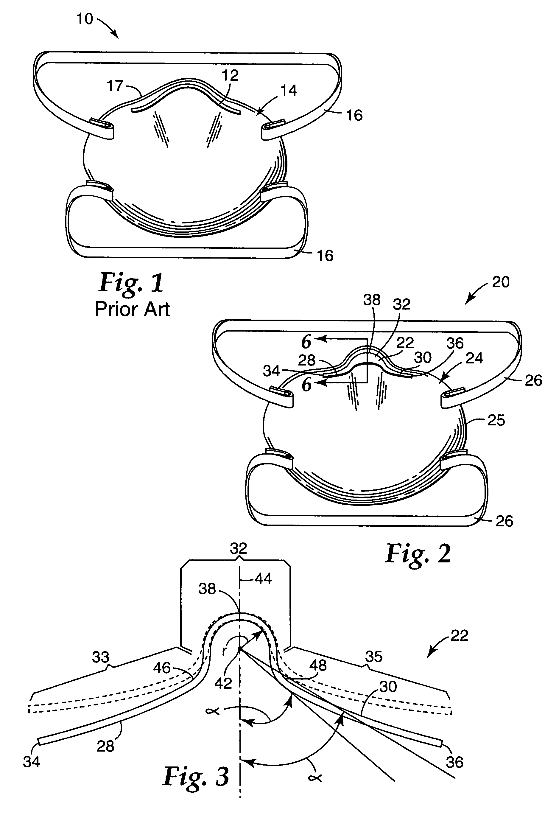 Respirator having preloaded nose clip