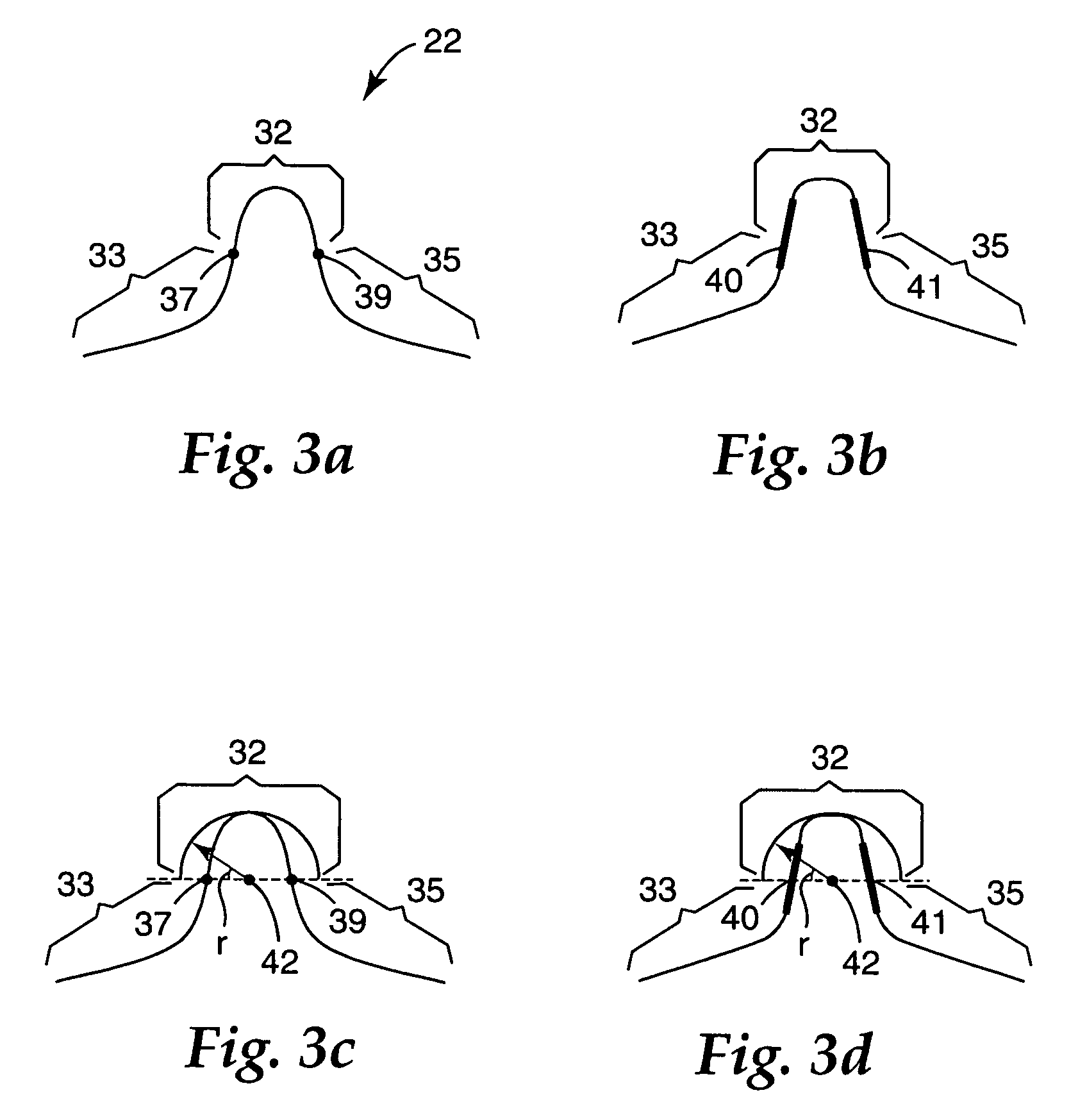 Respirator having preloaded nose clip