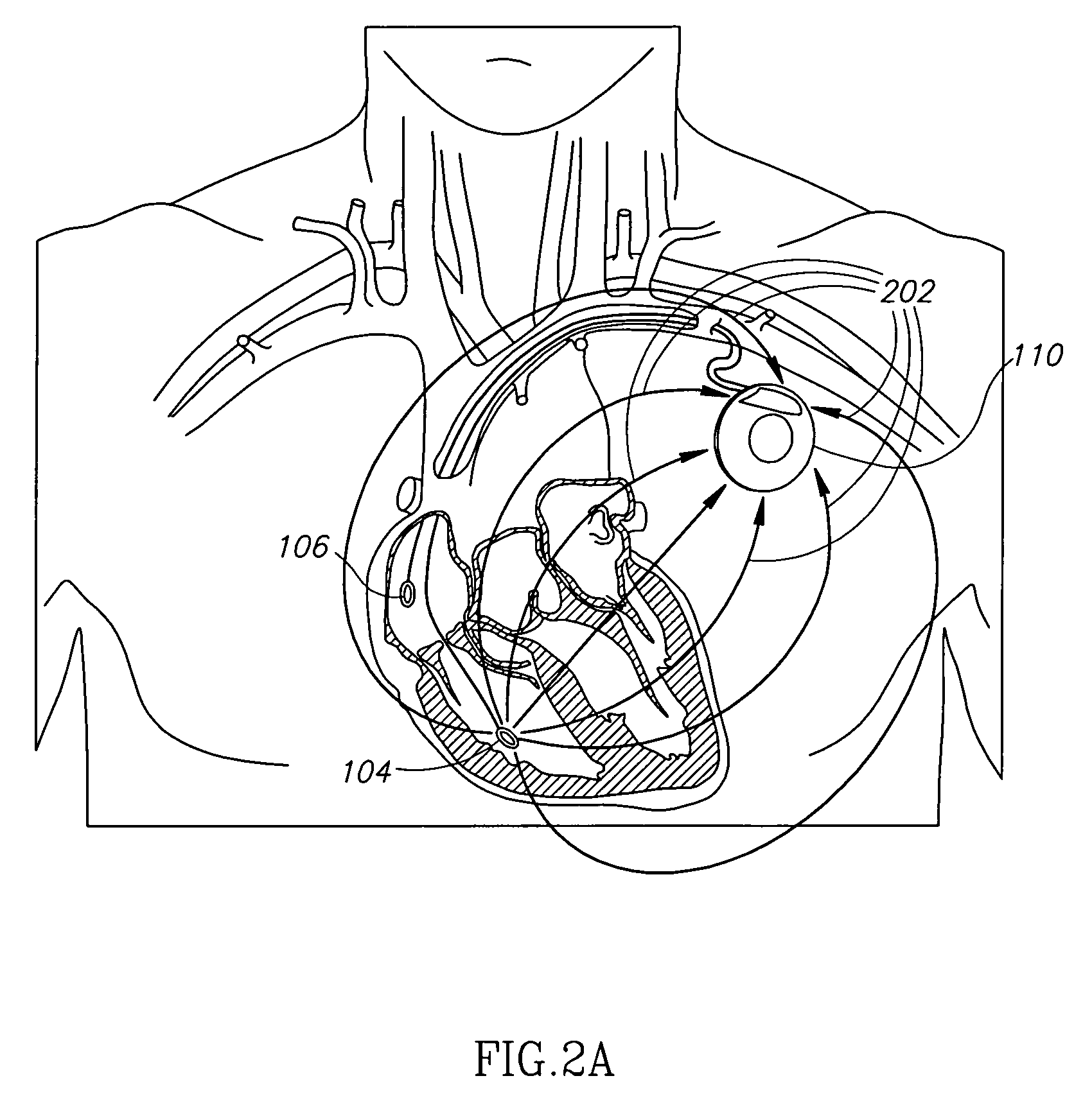 Bio-impedance apparatus and method