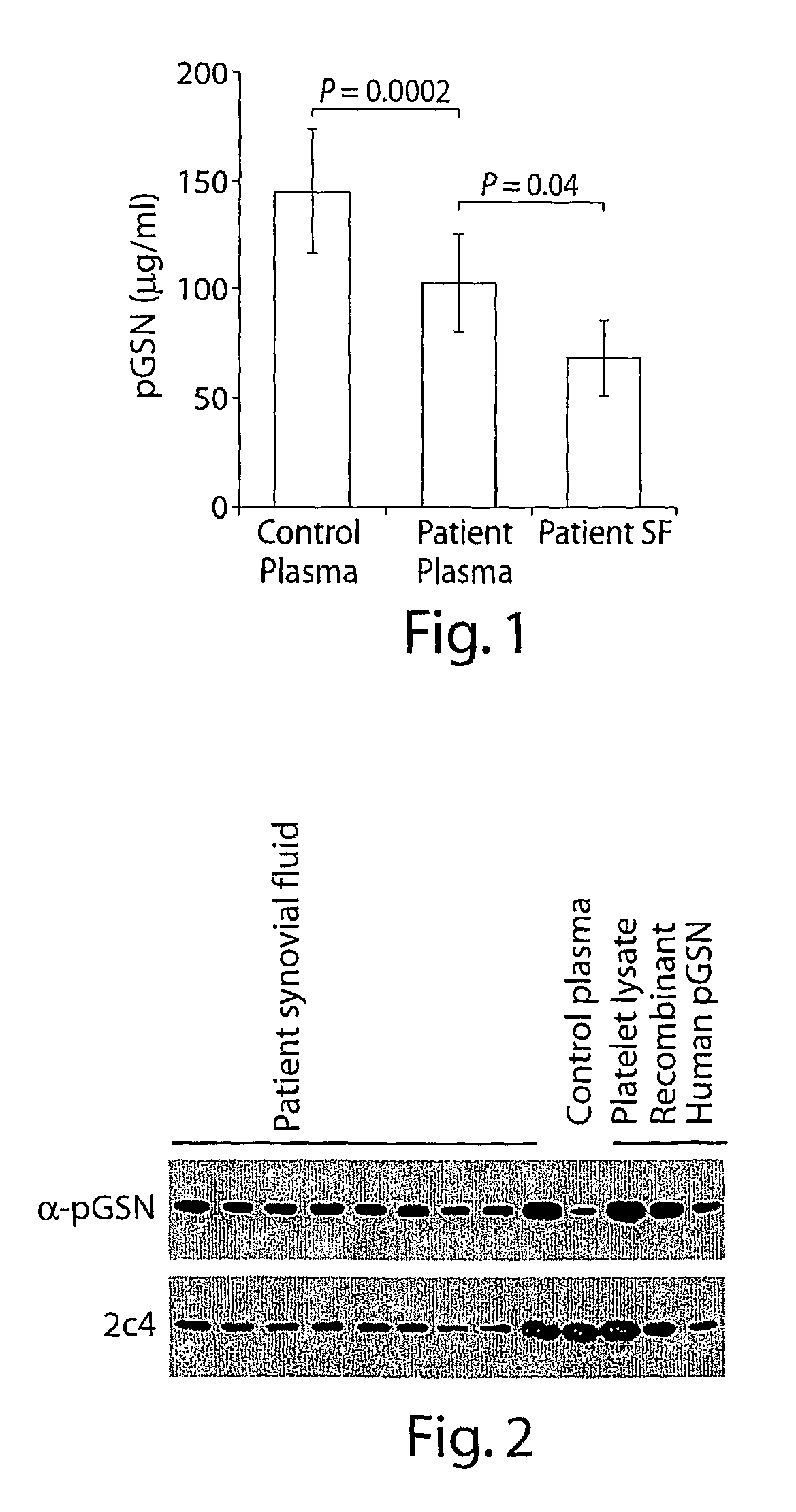 Methods of using gelsolin levels to characterize a subject's risk of developing rheumatoid arthritis