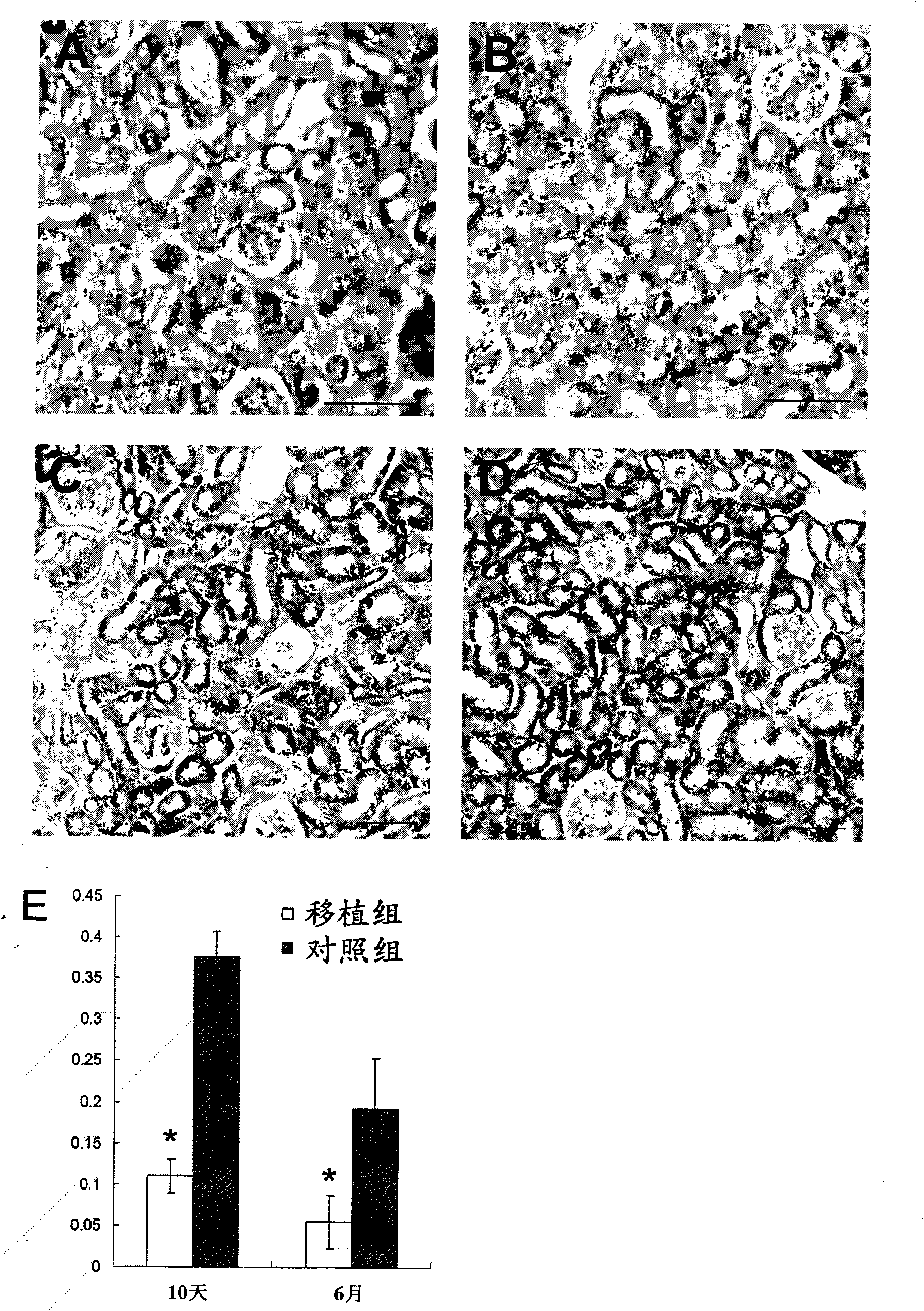 Use of human fat-derived mesenchymal stem cells in treatment of diseases in kidney and ocular fundus