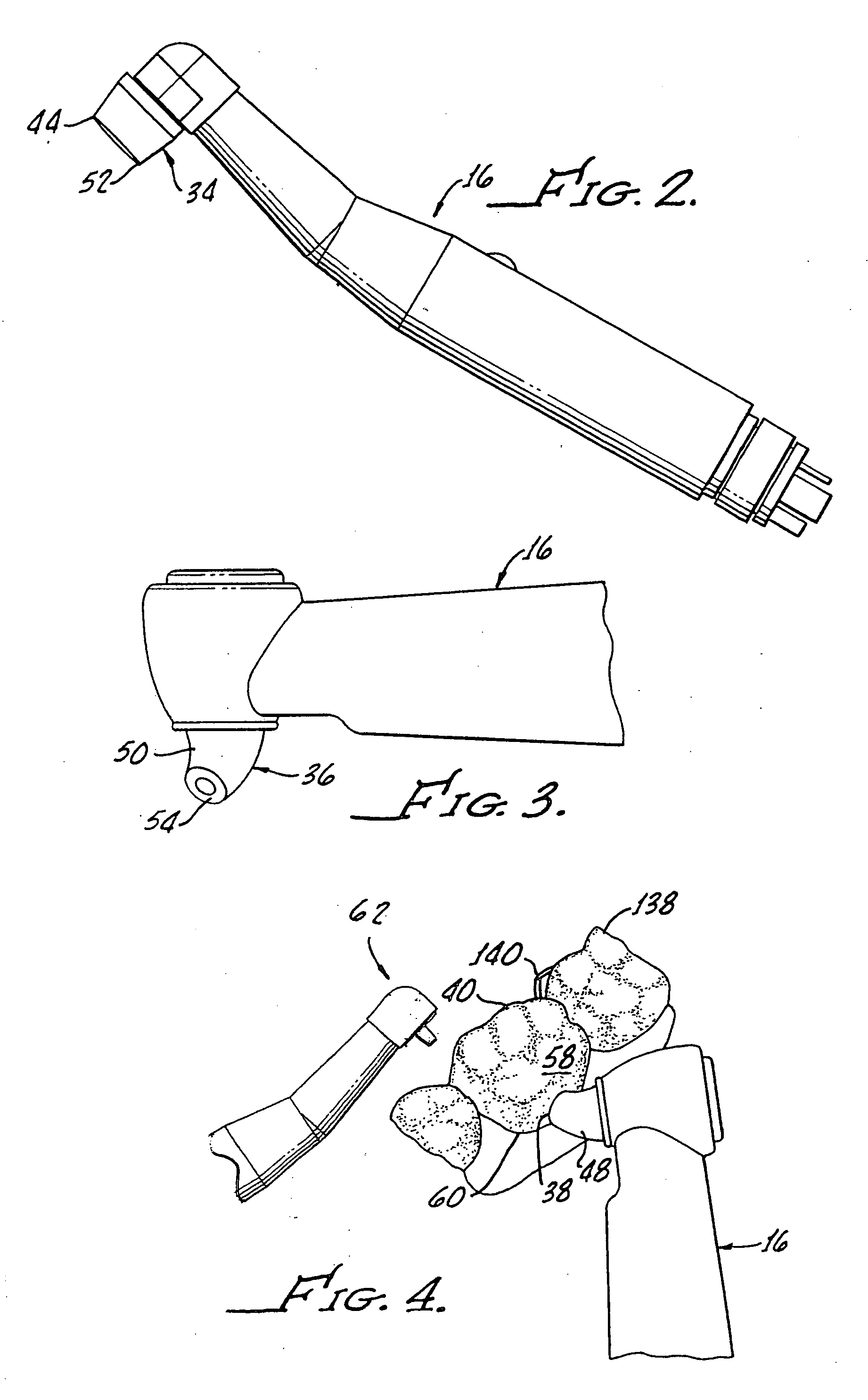 Method and apparatus for treating dentin sensitivity