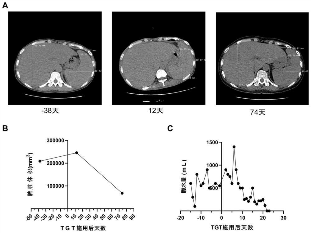 Application of Tripterygium wilfordii Polyglycoside Tablets in the Preparation of Medicines for Alleviating and/or Treating Symptoms Related to Hemophagocytic Syndrome