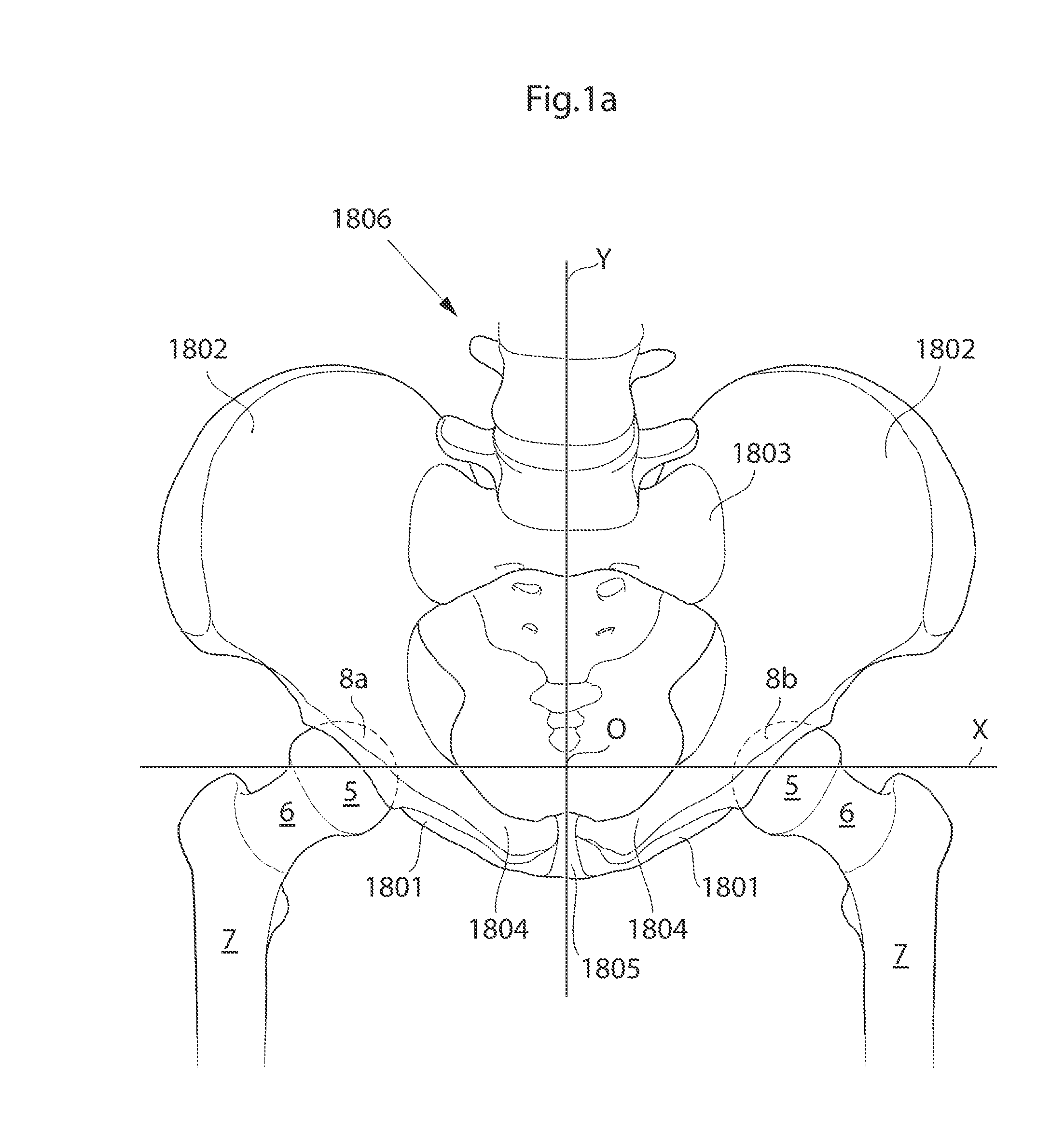 Hip joint device