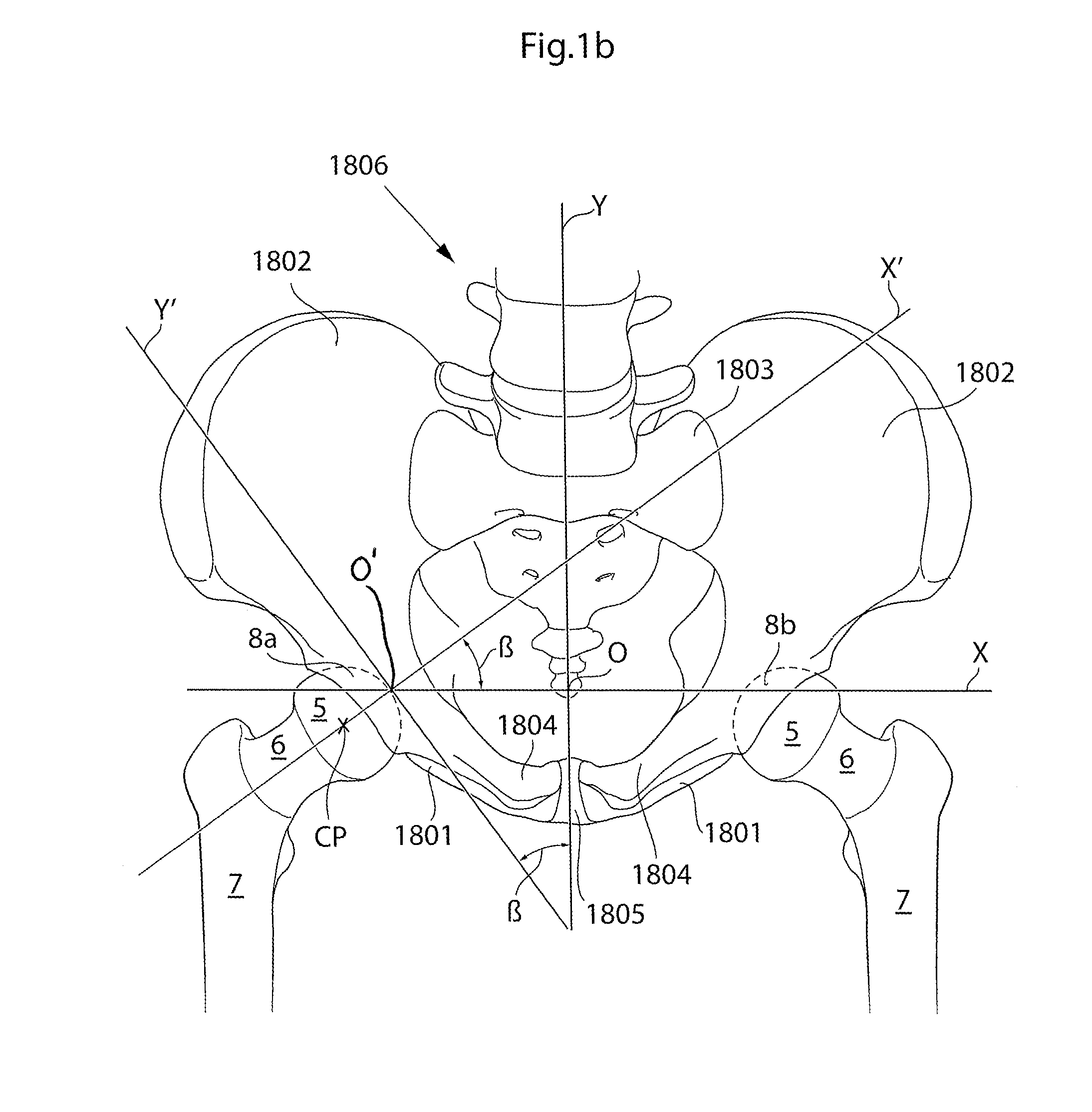 Hip joint device