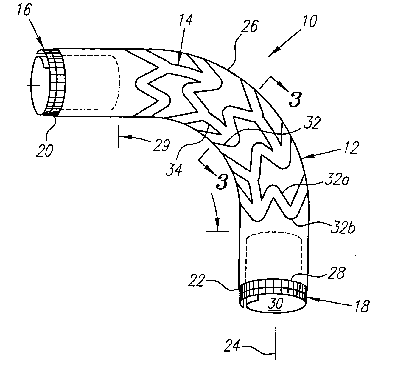 Stretchable anti-buckling coiled-sheet stent