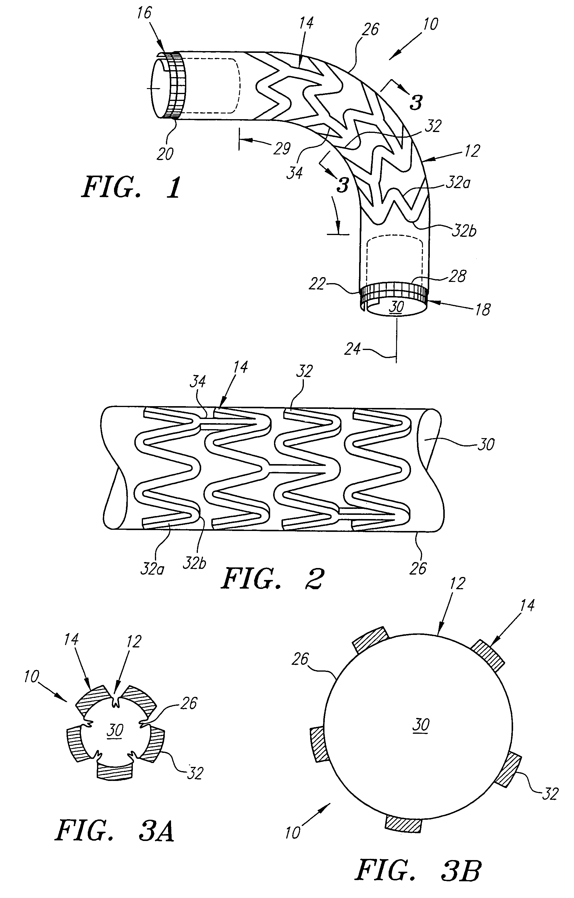 Stretchable anti-buckling coiled-sheet stent