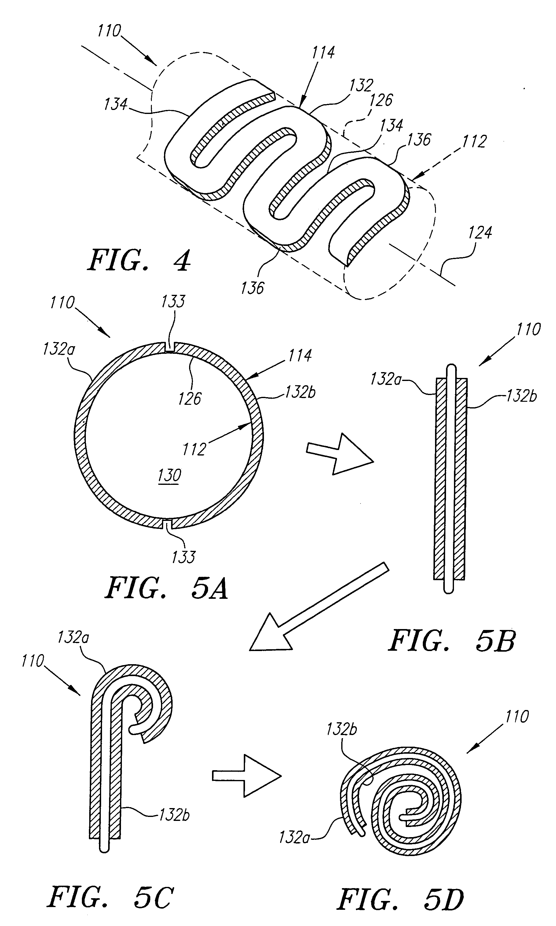 Stretchable anti-buckling coiled-sheet stent