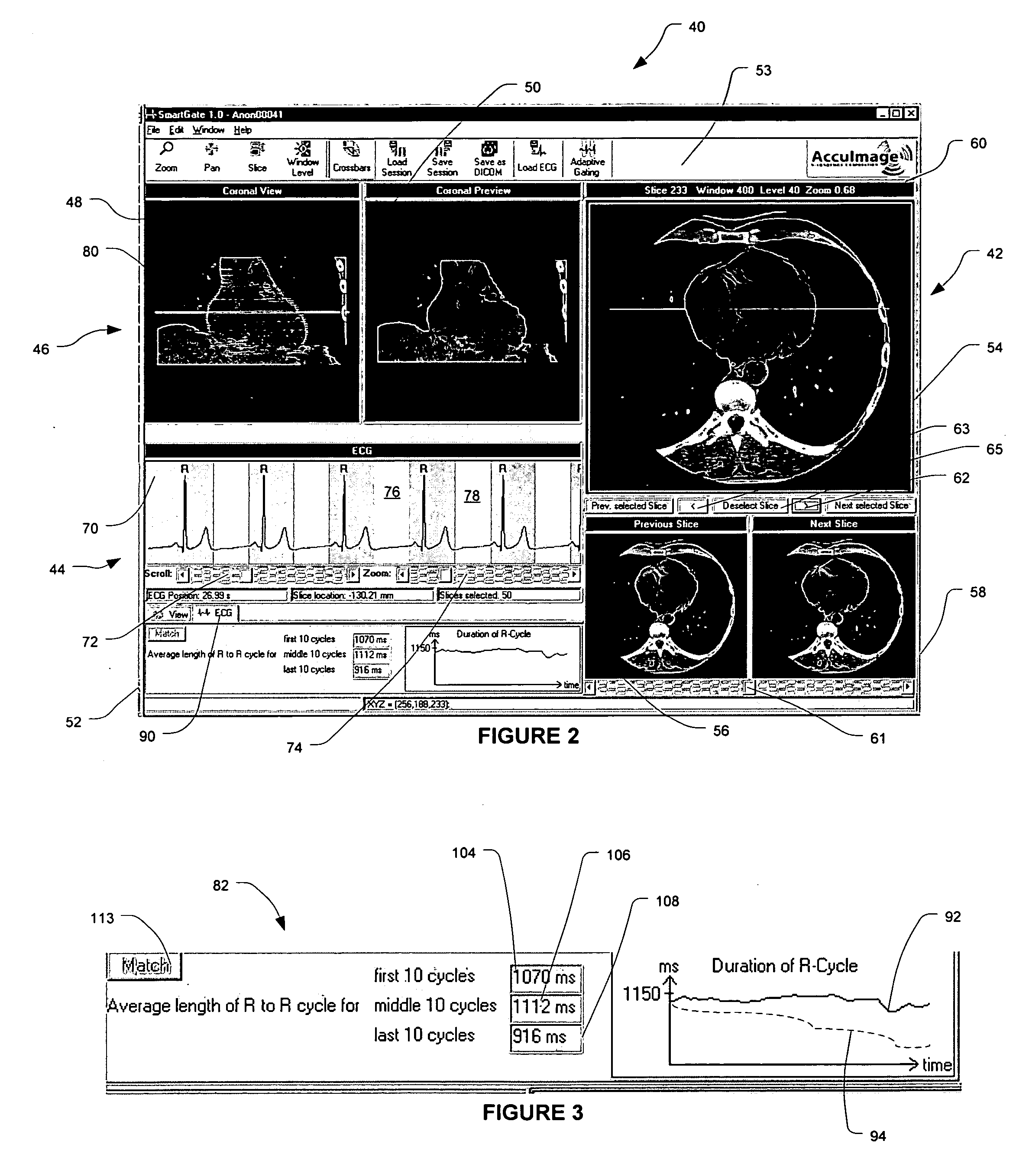 Methods and software for self-gating a set of images