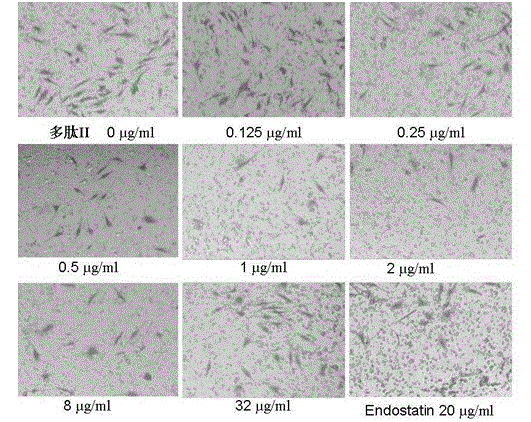 Matrix metallo-proteinase inhibitor polypeptide and application thereof